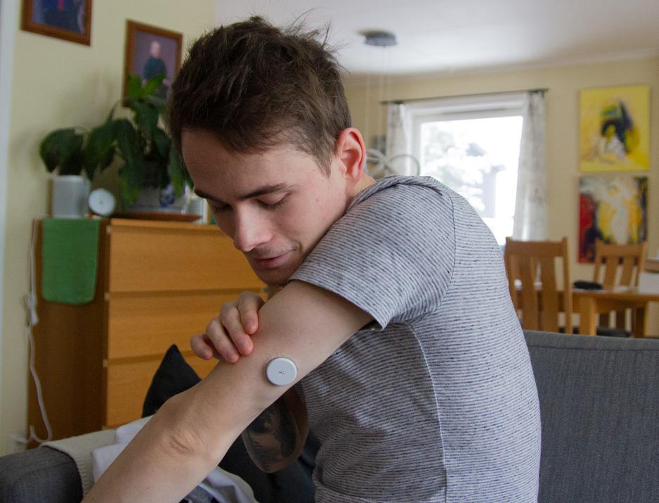 Bildet viser en ung gutt som holder ut armen sin. P&aring; baksiden av overarmen har han en hvit kloss - en insulinsensor. 