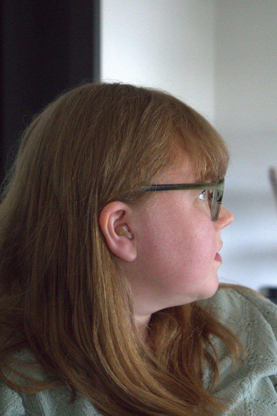 Kvinne med r&oslash;dt h&aring;r med gjennomsiktig st&oslash;ypropp i &oslash;ret i profil. 