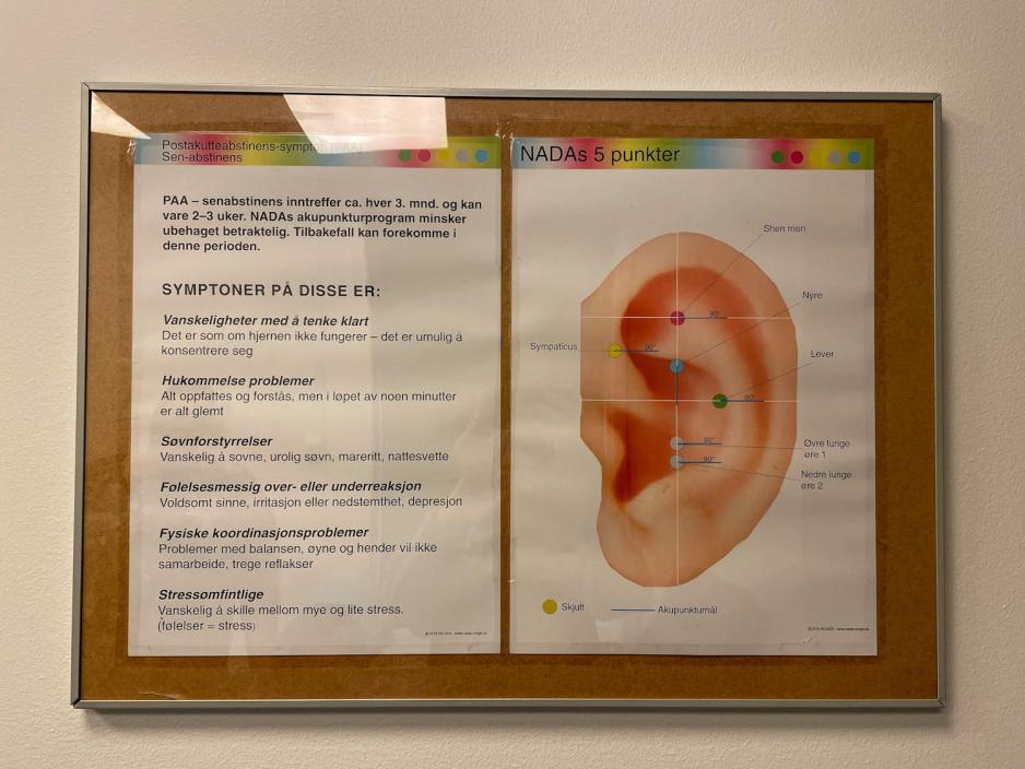 ​En plakat om NADA-&oslash;reakupunktur.